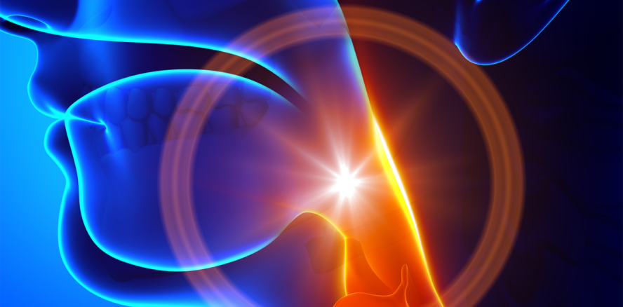 Influenzaforschung: Grippe-Herd „weicher“ Gaumen