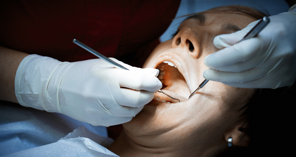 Neue Studie: Nikotin verändert bakterielles Gleichgewicht im Mund