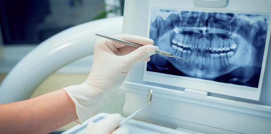 Uni Greifswald: Studie zu Mundgesundheit bei Flüchtlingen