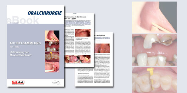 Neues eBook und ZWP-Thema rücken Nebenschauplatz in den Fokus