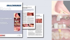 Neues eBook und ZWP-Thema rücken Nebenschauplatz in den Fokus