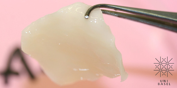 Erstmals Nasenflügel mit gezüchtetem Gewebe rekonstruiert