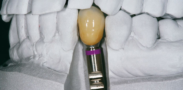 Natur trifft Restauration