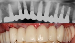 Der ältere Mensch – die navigierte Chirurgie