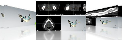 Am Puls von morgen – digitale Zahnmedizin von Nobel Biocare
