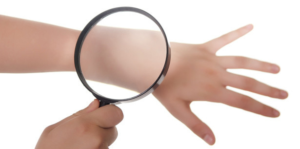 Versorgungslage bei Neurodermitis verbessern