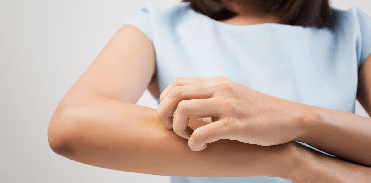 Arthritismedikament erfolgreich bei Neurodermitis eingesetzt