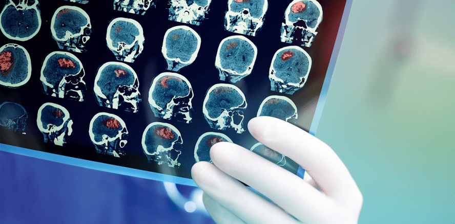 Der Nutzen der Gehirnforschung in der Prophylaxesitzung