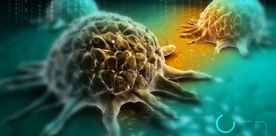 Mundhöhlenkrebs verursachte Oberarmtumor