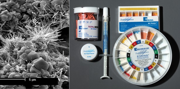 Ein universelles biokeramisches Obturationsmaterial