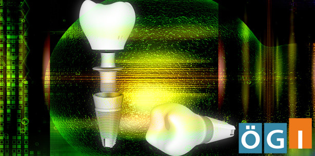 ÖGI-Jahrestagung 2013: Die digitalisierte Implantatmedizin