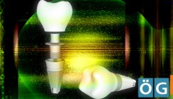 ÖGI-Jahrestagung 2013: Die digitalisierte Implantatmedizin