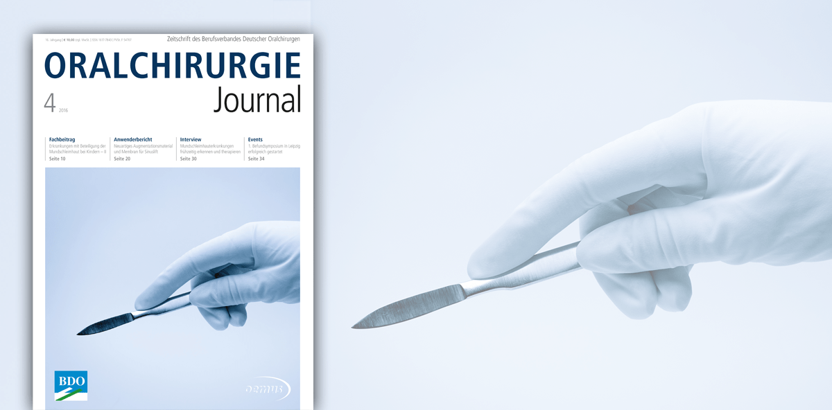 Aktuelles Oralchirurgie Journal widmet sich Speicheldrüsenerkrankungen