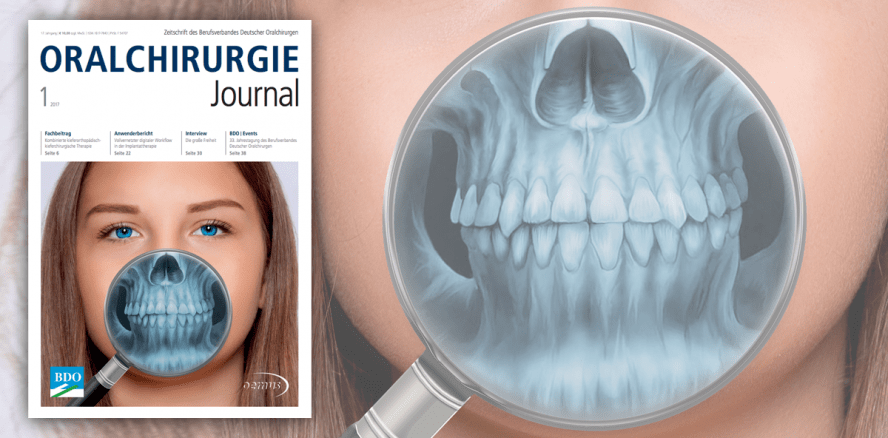 Oralchirurgie Journal: Erste Ausgabe des Jahres jetzt online lesen