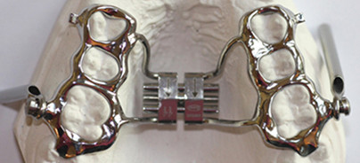 Herbst-Scharnier gewinnt wieder an Bedeutung