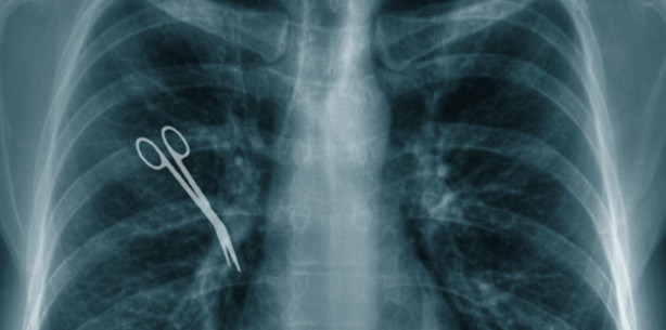 Nach Operation 16 Fremdkörper in Patient entdeckt