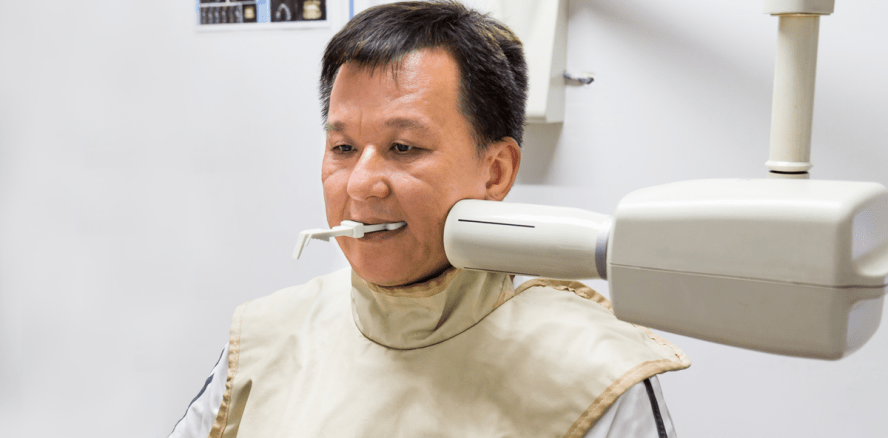 Studie: Skepsis gegenüber Krebsgefahr beim Röntgen