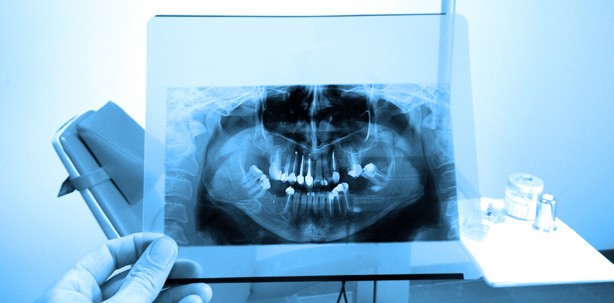 OPT vor Untersuchung berechtigt?