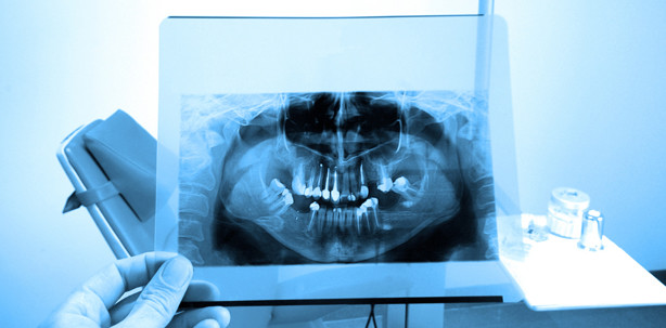 OPT vor Untersuchung berechtigt?