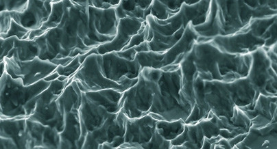 Kann die Nanotechnologie etwas für den klinischen Alltag bieten?