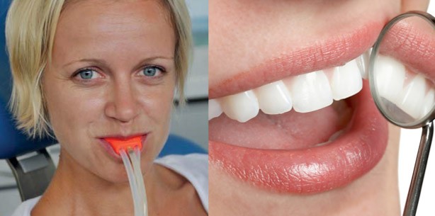 Ozontherapie – eine Alternative bei Parodontitis?
