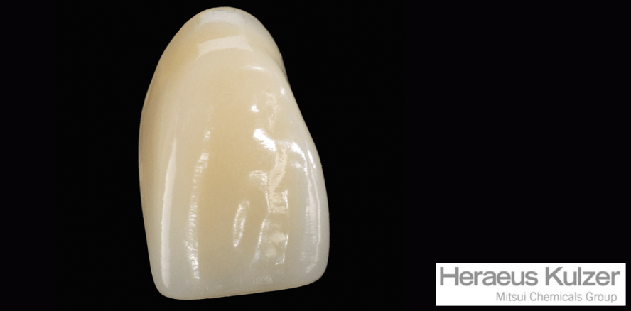 10 Jahre Pala® Mondial – 50 Jahre INCOMP-Verfahren