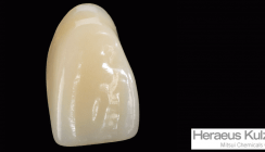 10 Jahre Pala® Mondial – 50 Jahre INCOMP-Verfahren