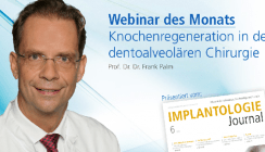 Heute: Kostenloses Live-Webinar zur Thematik Knochenregeneration