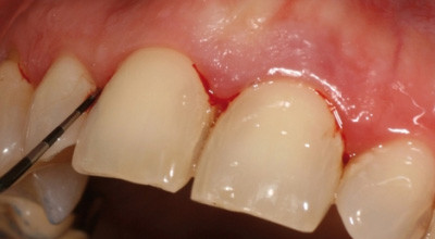 PAR-Risikoanalyse und Konsequenzen für die Praxis