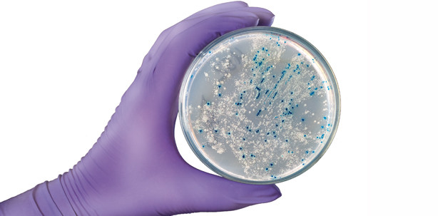 Parodontitis mit weitreichenden Folgen