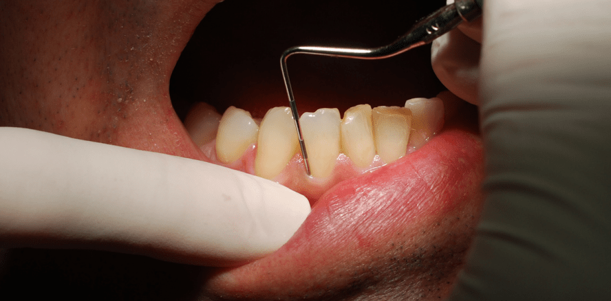 Grenzen überschreiten