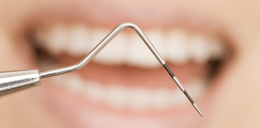 Neue Studie: Auch ohne Fluorid gegen Parodontitis