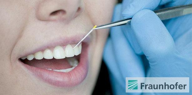 Parodontitis-Erreger schnell erkennen