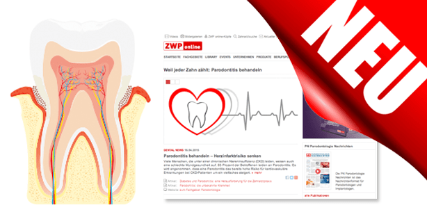 Weil jeder Zahn zählt: ZWP-Thema zur Volkskrankheit Parodontitis