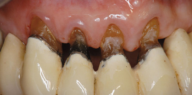 Auch das Parodontium altert!