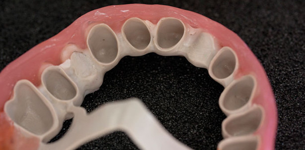 „Innovativ, biokompatibel und röntgendurchlässig“