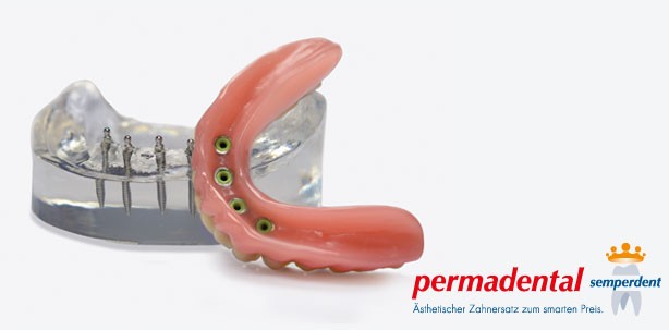 PERMADENTAL kooperiert mit Mini-Implantat-Hersteller