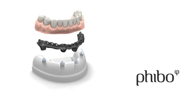 Phibo® präsentiert Phixoss® & Certia Guide® auf der IDS
