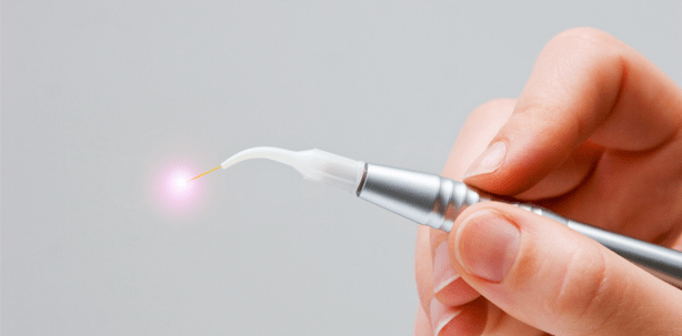 Die Photodynamik in der dentalen Anwendung