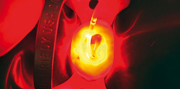 Photodynamische Therapie in der Endodontie