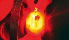 Photodynamische Therapie in der Endodontie