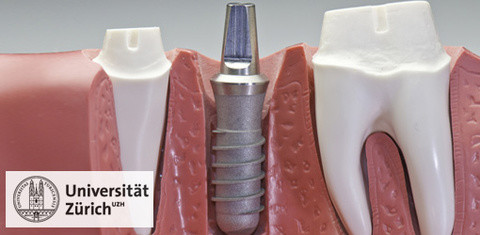 Implantate unter Strom