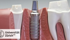 Implantate unter Strom