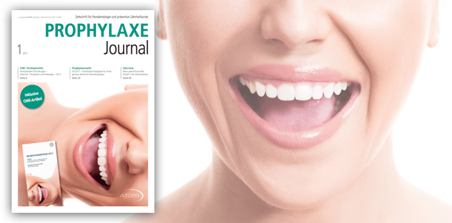 Von Diamantzahnpasta bis Hypnose: Prophylaxe Journal online