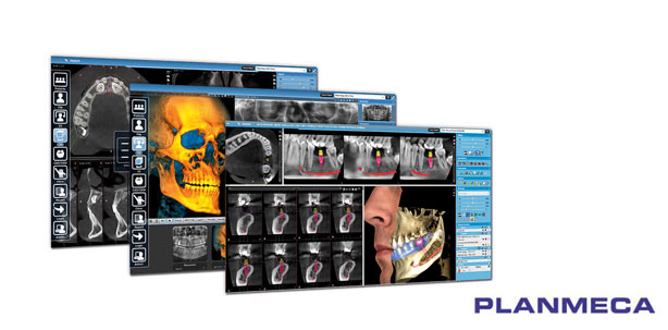 IDS 2015 – Planmeca präsentiert Neuheiten für den digitalen Workflow