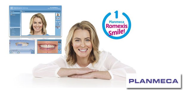 Planmeca Romexis® Smile Design für ein harmonisches Lächeln