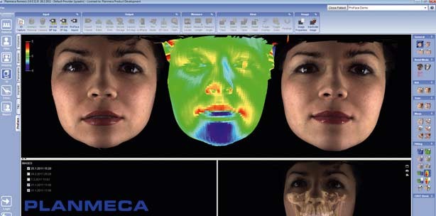 Planmeca ProMax 3D Röntgen gewinnt Produkt Design Award
