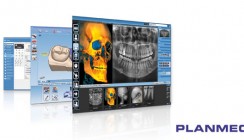 Eine Software für alles: Planmeca Romexis 4.0