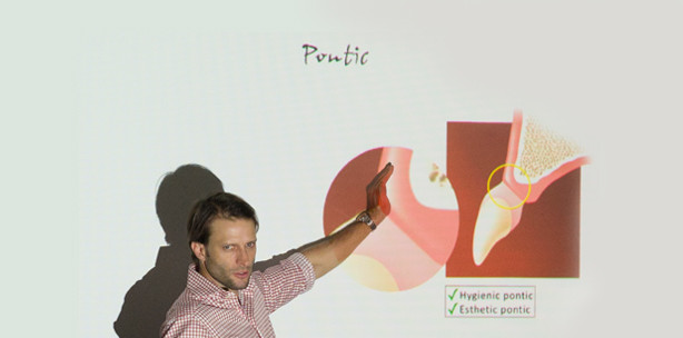 Pink Komposit – Kurs in Stuttgart