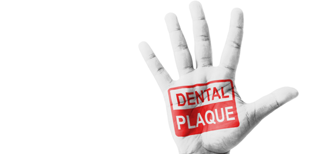 Für sichere Zahnimplantate: Mit dem Plasma-Jet gegen den Biofilm